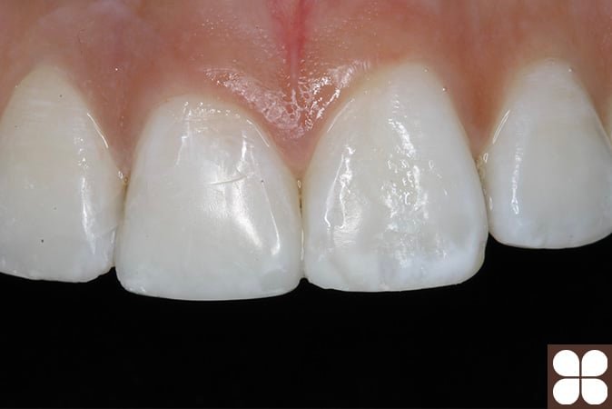 cosmetic dentistry Fairfax, VA