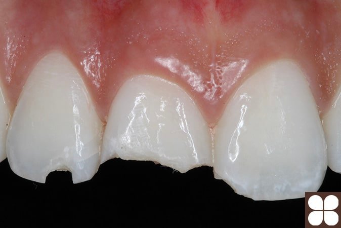 cosmetic dentistry Fairfax, VA