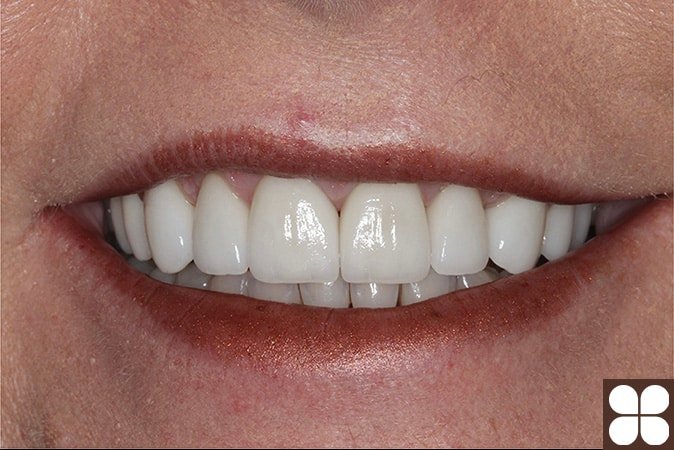 cosmetic Dentistry Fairfax, VA