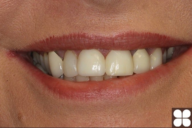 cosmetic Dentistry Fairfax, VA