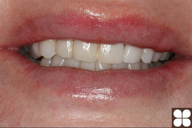 cosmetic Dentistry Fairfax, VA