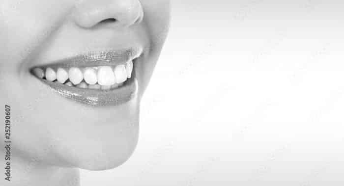 Beautiful teeth with dental crowns