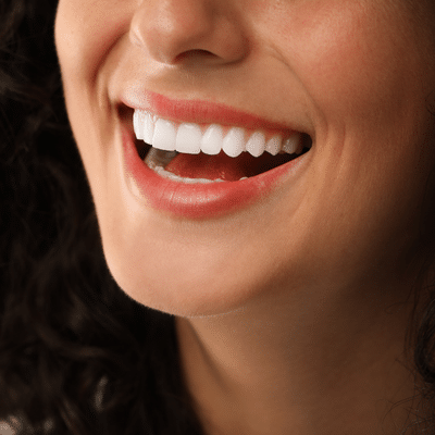 close-up of a woman's smile, representing cosmetic dental treatments