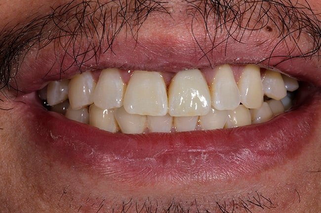 after cosmetic dentistry Fair Lakes Family and Cosmetic Dentistry