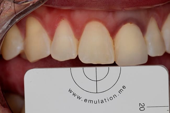 before cosmetic dentsitry Fair Lakes Family and Cosmetic Dentistry