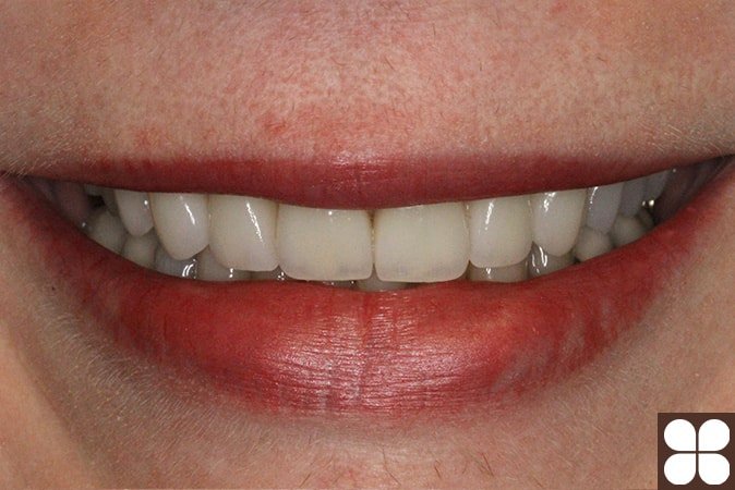 cosmetic dentistry Fairfax, VA