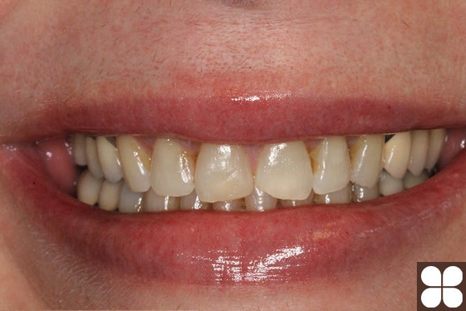 cosmetic dentistry Fairfax, VA