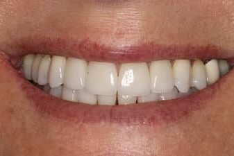 Cosmetic Dentistry Fairfax, VA