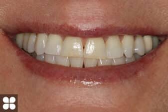 Cosmetic Dentistry Fairfax, VA