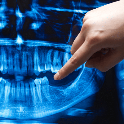 dental x-ray Fair Lakes Family and Cosmetic Dentistry