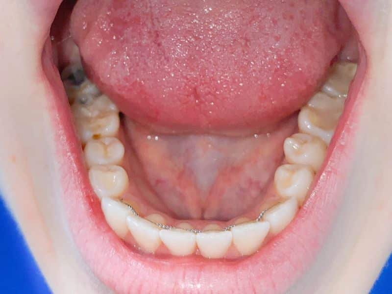 VirtualSmileAssessment3 virtual smile assessment