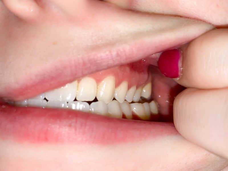 VirtualSmileAssessment4 virtual smile assessment