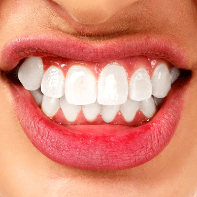 bruxism Fair Lakes Family and Cosmetic Dentistry